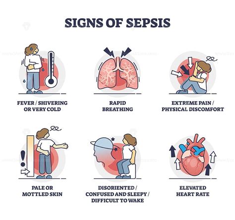 Signs of sepsis as infection blood poisoning symptoms outline collection - VectorMine