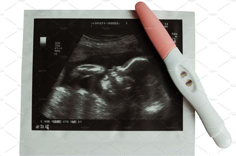 Ultrasound picture of baby with pregnancy test containing photo, ultrasound | High-Quality ...