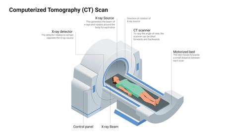 Computerized Tomography (CT) Scan | GI Update