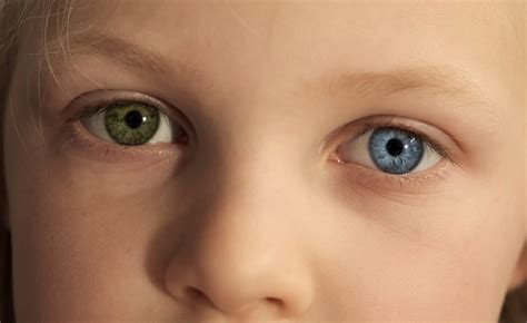 Close up of little kid eyes of different colors. Child with complete ...