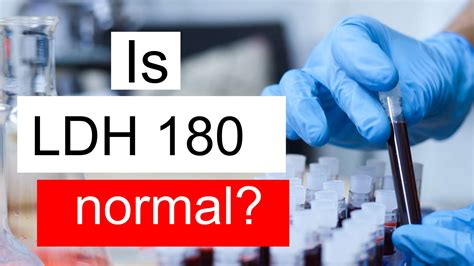 Is LDH 180 normal, high or low? What does Lactate dehydrogenase level 180 mean?