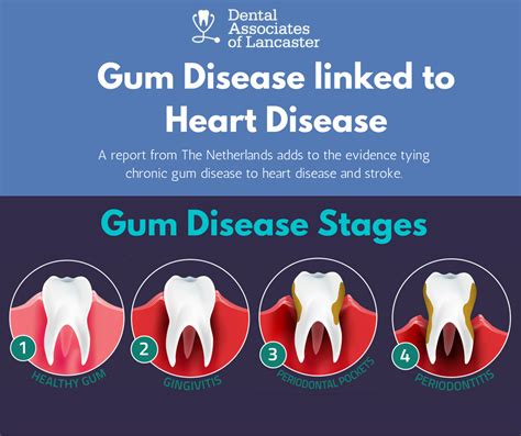 Gum disease linked to heart disease - Dental Associates of Lancaster, Ohio 43130