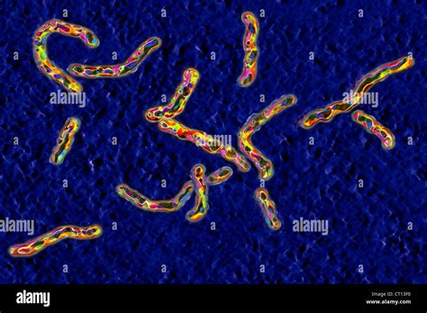 Mycobacterium Tuberculosis Microscope Stock Photos & Mycobacterium ...