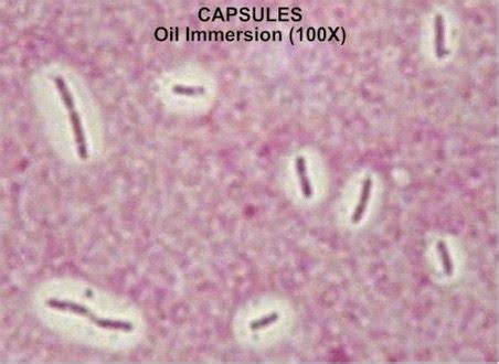 microbiology: Bacterial capsule