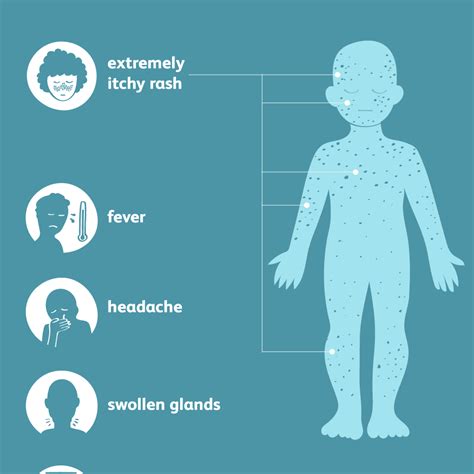 Chickenpox: Signs, Symptoms, and Complications