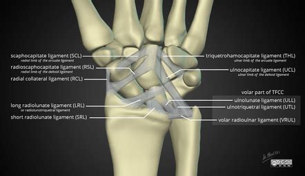 Ulnar Collateral Ligament Wrist Mri