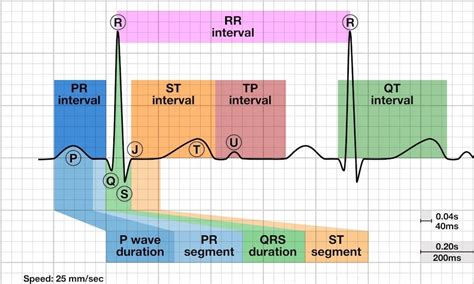 Introduction to the ECG