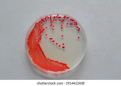 Serratia marcescens - Marcelle Beeler