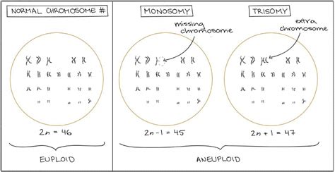 Aneuploidy: Definition, Types and Disorders | READBIOLOGY.COM