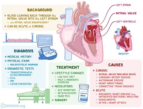 Mitral Valve Regurgitation: What Is It, Causes | Osmosis