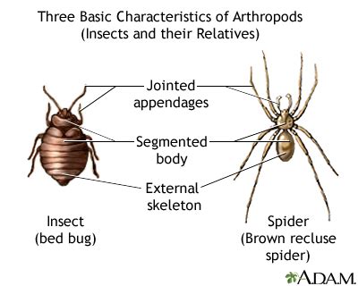 Arthropods - basic features: MedlinePlus Medical Encyclopedia Image