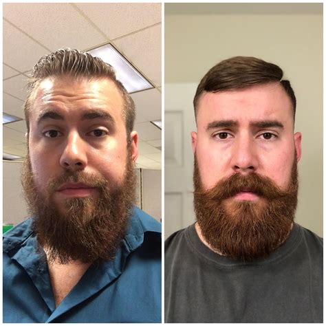 Beard Growth Supplement Before And After | Beard Style Corner