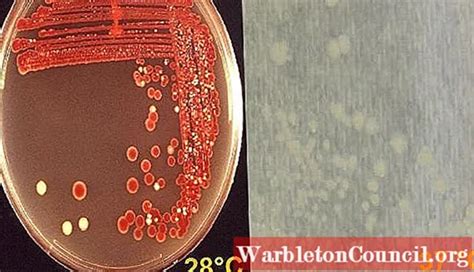 Serratia marcescens: characteristics, pathology and symptoms - science ...