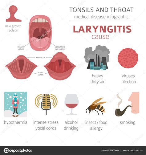 Tonsils Throat Diseases Laryngitis Symptoms Treatment Icon Set Medical Infographic — Stock ...