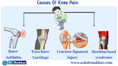 Knee pain Homeopathic treatment protocol using homeopathy by Dr Makkar