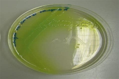 Agar cetrimida: fundamento, preparación, usos