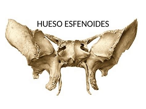 hueso esfenoides anatomia humana | Diapositivas de Anatomía | Docsity