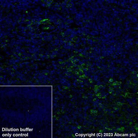 Recombinant Alexa Fluor® 488 Anti-VISTA antibody [EPR21050] (ab314678 ...