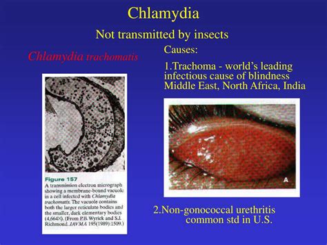 PPT - Classification of Bacteria PowerPoint Presentation, free download ...