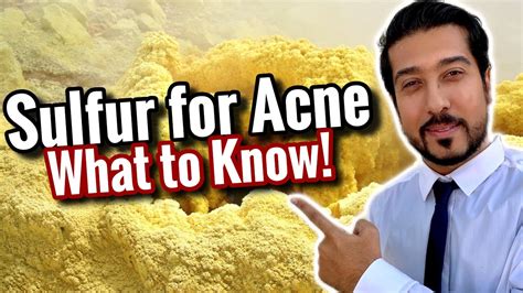 Sulfur for Acne Scars | How to Use Sulfur Soap, Masks, and Spot Treatment - YouTube