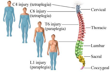 Spinal Cord Injury Flashcards | Quizlet