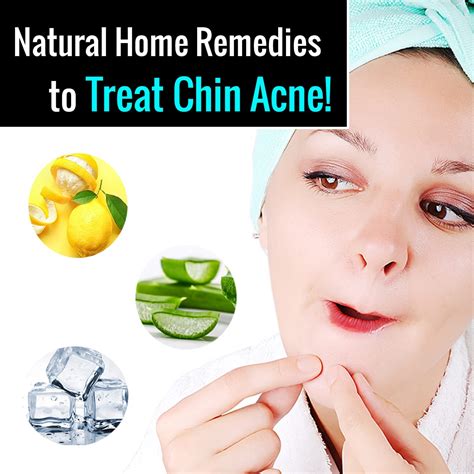 Chin Acne - How to Treat Chin Acne with Natural Home Remedies!