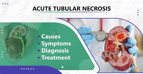 Acute Tubular Necrosis: Causes, Symptoms, Diagnosis, and Treatment