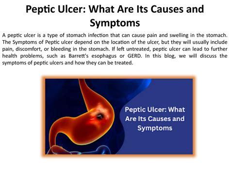 What Signs and Symptoms Indicate a Peptic Ulcer? by Safe Surgery Center - Issuu