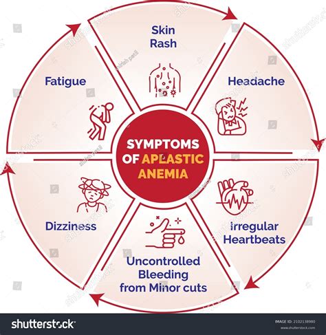 Aplastic Anemia Skin Rash Headache Fatigue Stock Vector (Royalty Free ...