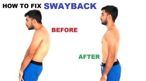 Swayback Exercises