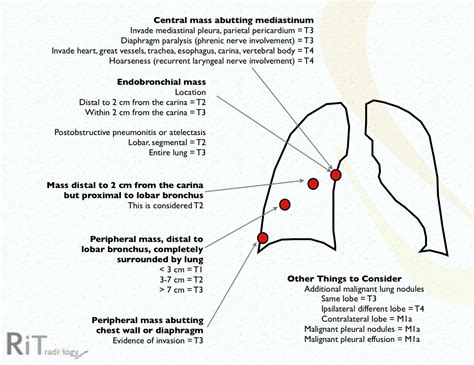 RiT radiology: 2009 Non-Small Cell Lung Cancer Staging System (3)