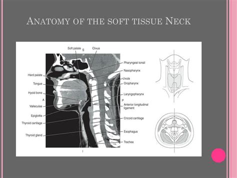 Soft Tissue Neck Anatomy