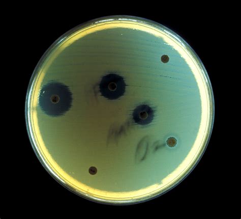 Free picture: aerobic, bacteria, escherichia coli, cultured, agar ...