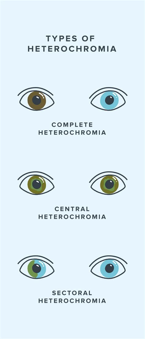 What Is Heterochromia of the Eyes? | Warby Parker