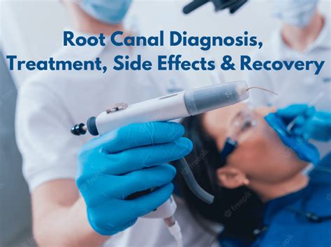 Root Canal Treatment, Side Effects & Recovery - Dentist Scranton PA