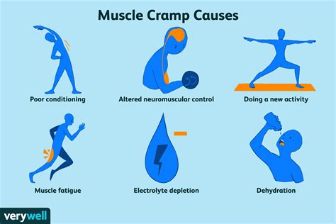 ancien vendeur Soussol when to worry about leg cramps doyen Placard Électropositif