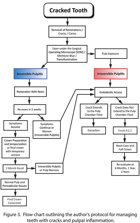 The Cracked Tooth: Diagnosis and Management - Oral Health Group