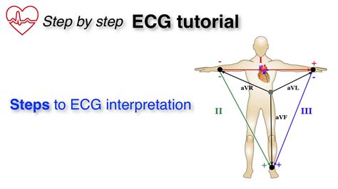 Ecg Explained