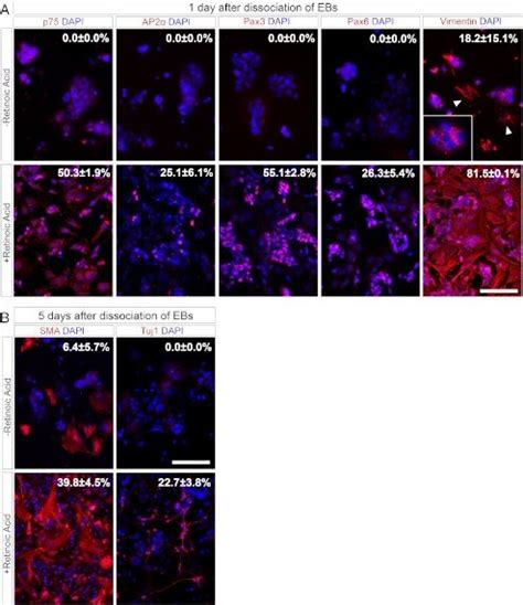 Neural crest related markers are expressed upon retinoic acid mediated ...