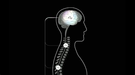 Neuralink's Upgraded Brain Chip Hopes to Help the Blind See and the ...