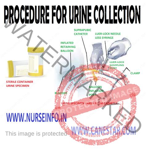 PROCEDURE FOR URINE COLLECTION - Guidelines