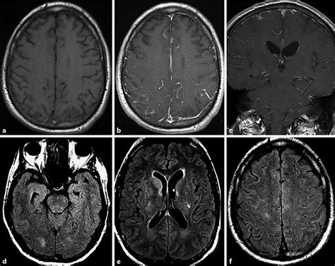 Mri With Or Without Contrast | Hot Sex Picture