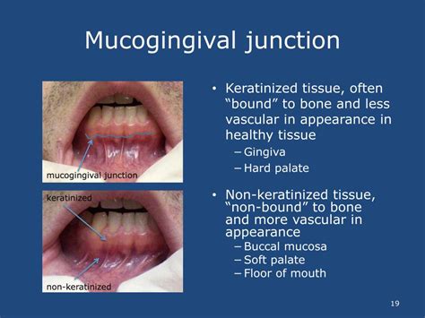 PPT - David Reznik , DDS Oral Examinations for Non-Dental Clinicians PowerPoint Presentation ...