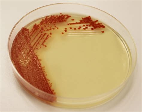 Environmental Isolate Case Files: Serratia marcescens – Microbiologics Blog