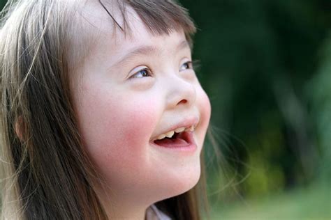 Down Syndrome - familydoctor.org