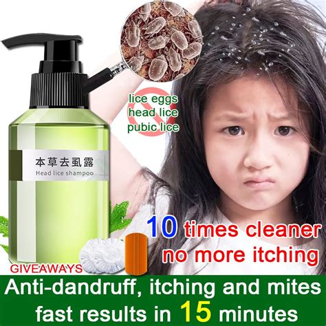 100mL lice remover shampoo Licealiz Head Lice Treatment Shampoo treatment lice remover shampoo ...