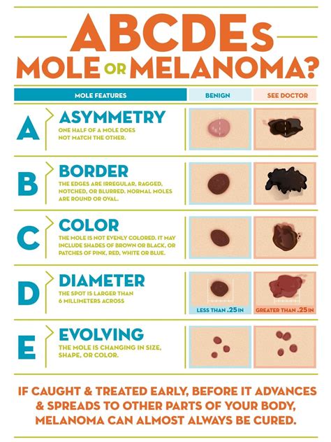 Melanoma Skin Moles