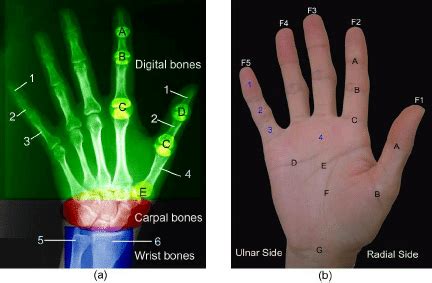 Human hand anatomy: (a) Bone Anatomy 1. Distal phalanx, 2. Middle... | Download Scientific Diagram