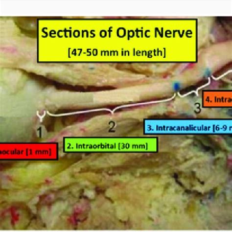 Optic Nerve Anatomy. The Optic Nerve is 47-50 mm in length extending... | Download Scientific ...