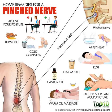 Review Of Pinched Nerve In Neck And Shoulder Treatment At Home References